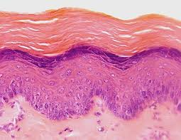 <p>Stratified squamous epithelium with surface layers packed with keratin, making it tough and water-resistant.</p>