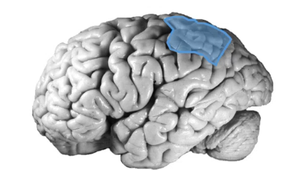 <p>the ______ _____ cortex handles higher sensory function (polysensory) and language function depending on hemisphere, and stereognosis , damage can cause _____ neglect more common in neglecting left side </p>
