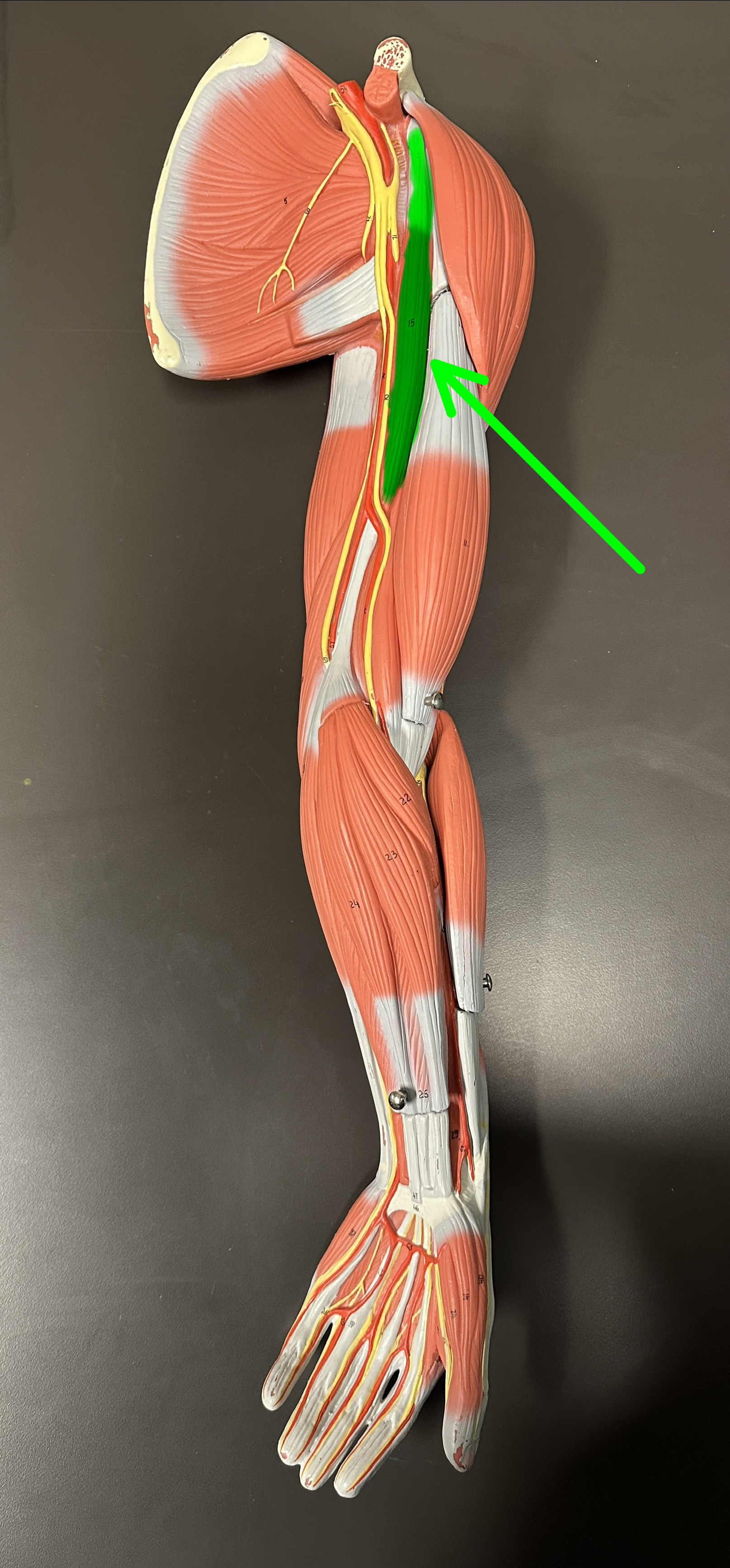 <p>What is the highlighted structure</p>