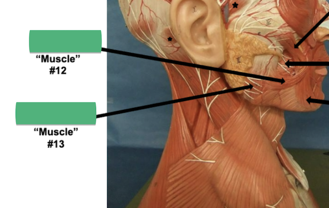 <p>Label muscle #13 </p>