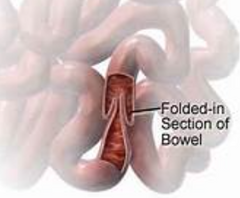 <p>What is this condition called? It is also an indication for a LGI study</p>