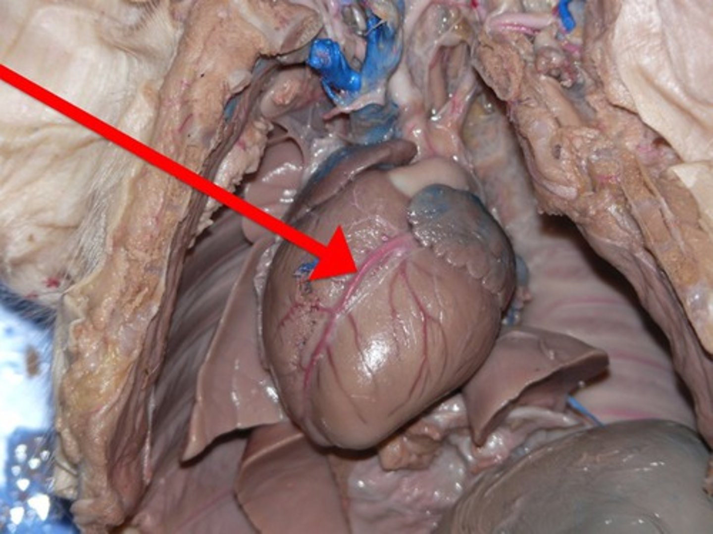 <p>Either of two arteries that arise one from the left and one from the right side of the aorta immediately above the semilunar valves and supply the tissues of the heart itself.</p>
