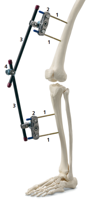 <p>Protective Cap for Fixation Pins</p>