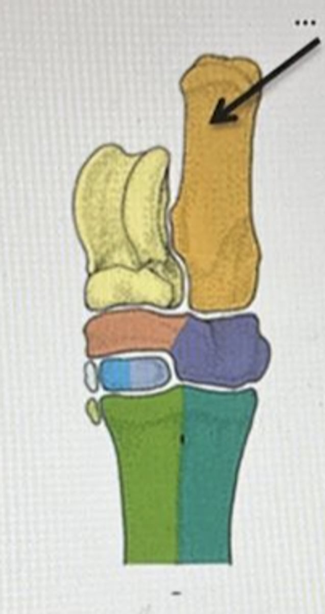 <p>A</p>