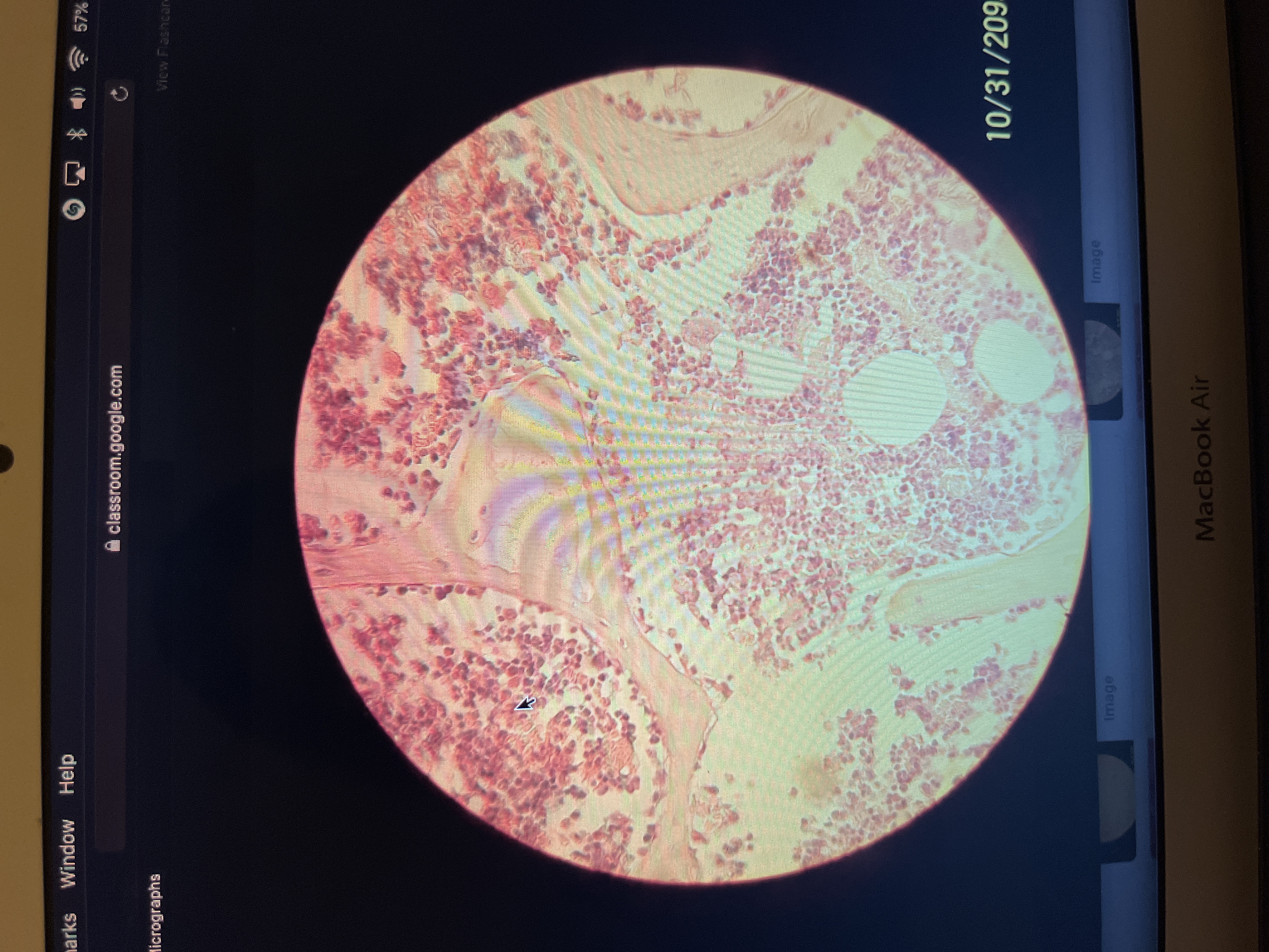 Location: various parts if bones of the body 
Function: support, protection, storage