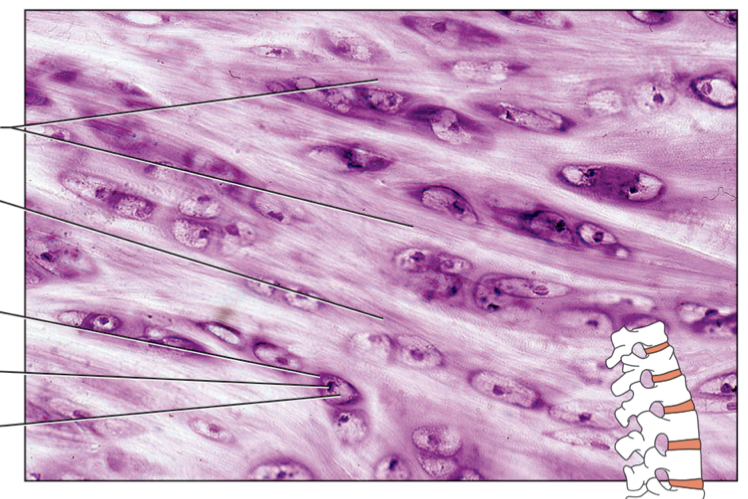 <p>name the components of the connective tissue from top to bottom. name the specific type of connective tissue </p>
