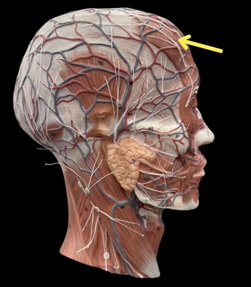 term image
