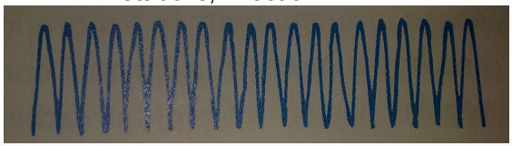 <p>Hyperpnea</p><p><em>Neurocirculatory asthenia</em></p>