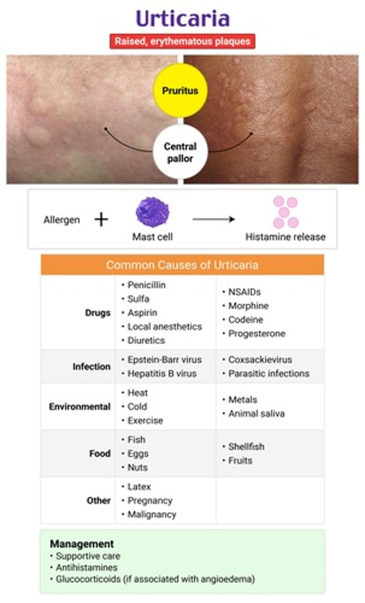 <p>urticaria → lesions are blanchable</p><p>histamine release from mast cells &amp; basophils in dermis = ↑ vascular permeability</p>
