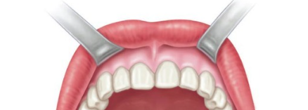 <p>Hard, enamel-covered structures in the jaws used for biting and chewing food.</p>