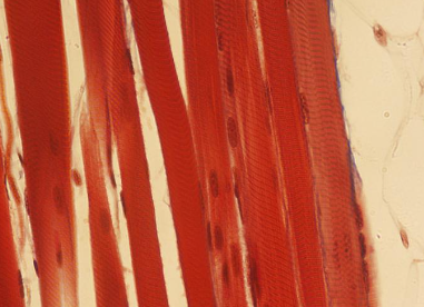 <p><span>Identify the type of muscle tissue shown?</span></p>