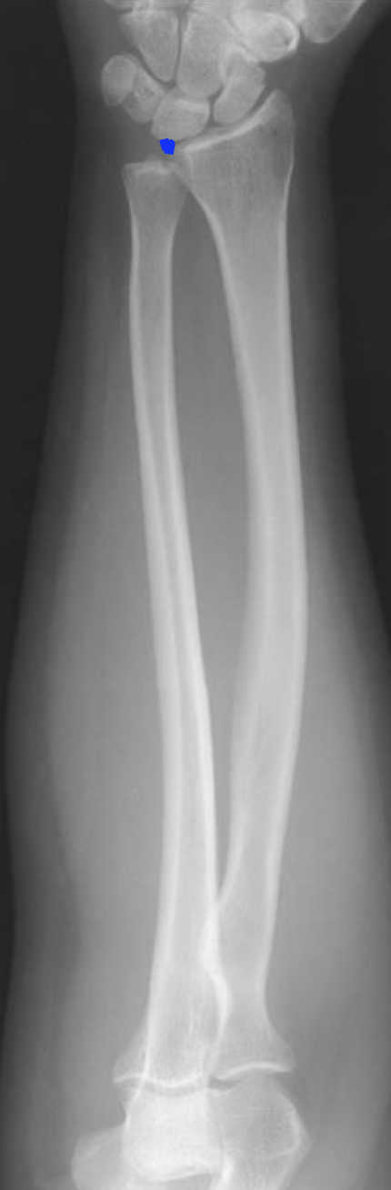 <p>what is this projection </p>