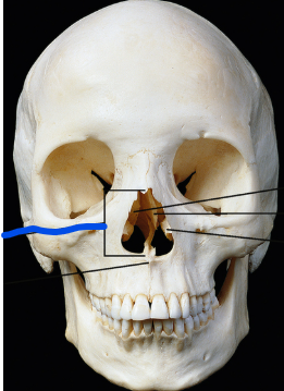 <p>Name the structure</p>