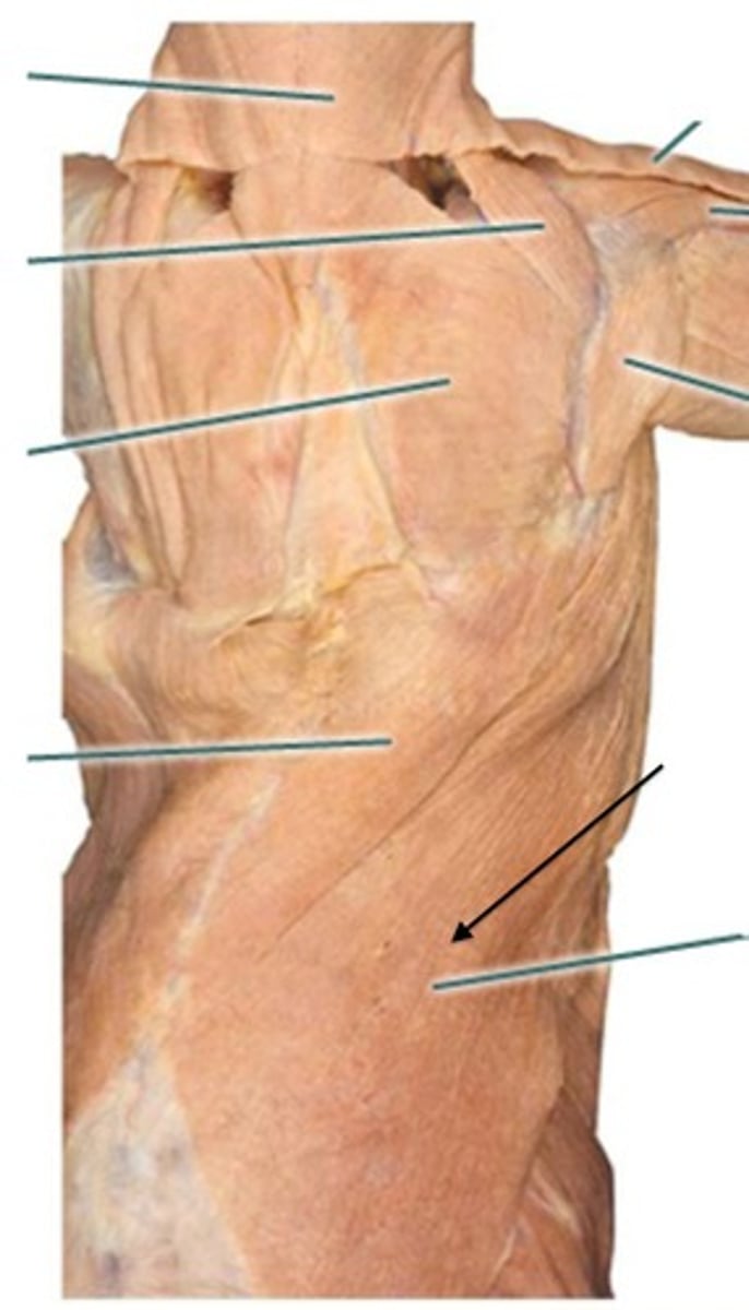 <p>name this muscle</p>