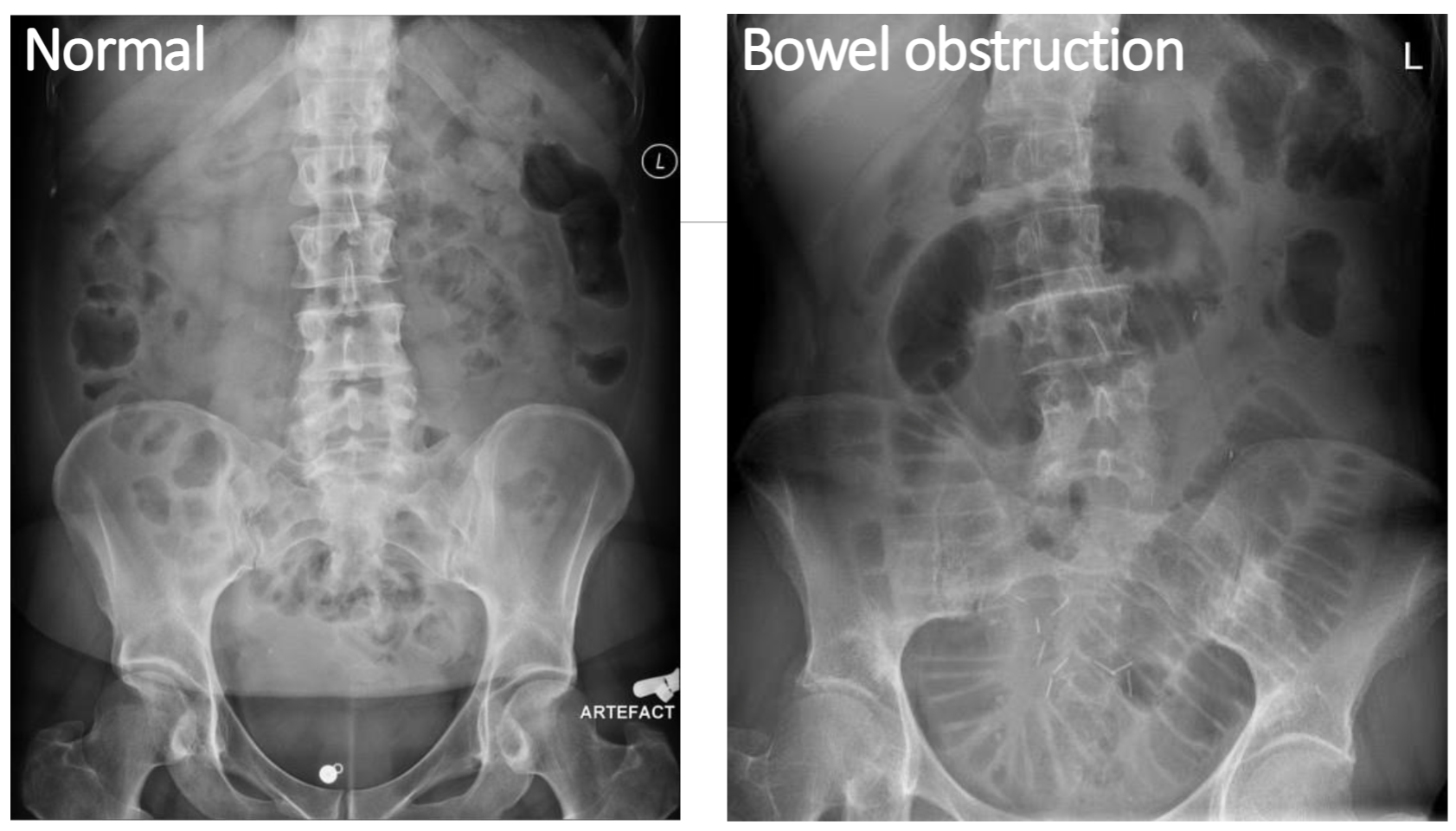 <ul><li><p>Airway causing hypoxia - reduced energy for eating, discomfort can reduce appetite</p></li><li><p>Oral-pharynx/esophagus - dysphagia(difficult swallowing)</p></li><li><p>Lower GI obstruction - nausea, vomiting, and abdominal pain reduces appetite and reduce GI absorption</p></li><li><p>Urinary Tract - discomfort can reduce appetite, acute kidney failure lead to vomitting</p></li></ul><p></p>