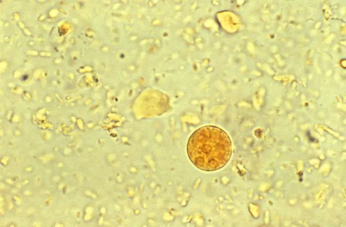 <p></p><ul><li><p>10-20 um</p></li><li><p>4 nuclei</p></li><li><p>when cyst matures, can have central chromatoidal body</p></li></ul><p></p>