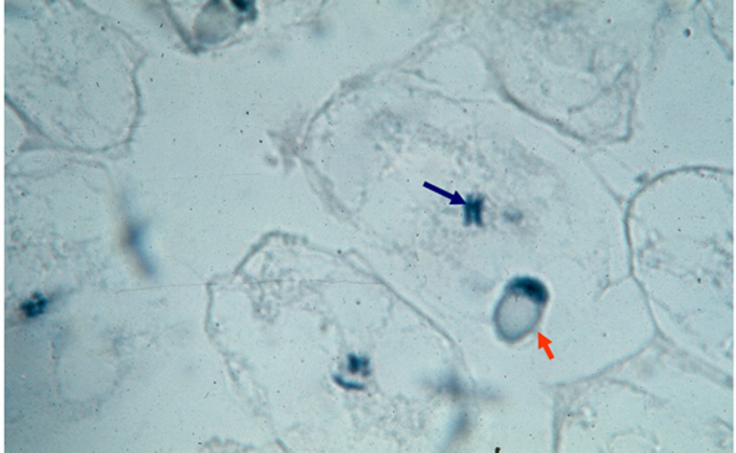 <p>This shows _______ in the parasitic worm, Ascaris lumbricoides. The red arrow indicates the ______ entering the ____ (the large clear bubbles). The blue arrow indicates the ___ _________, which have already started dividing.</p>