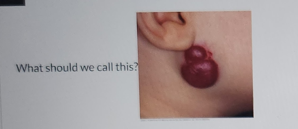 <p>what should be call this?</p>