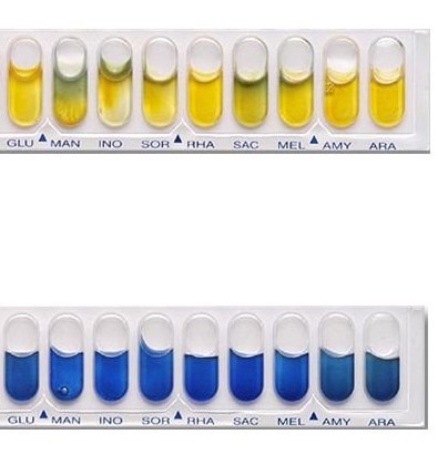 Are the YELLOW wells of the API20E test positive or negative?