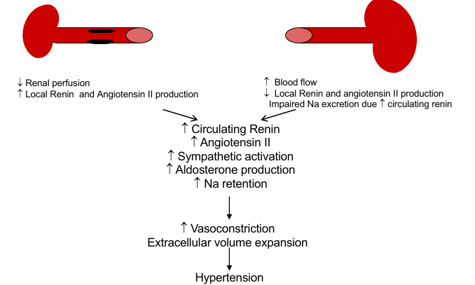 <p>-renal artery stenosis</p>