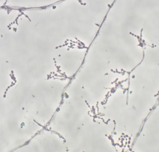 <p>Talaromyces marneffei</p>