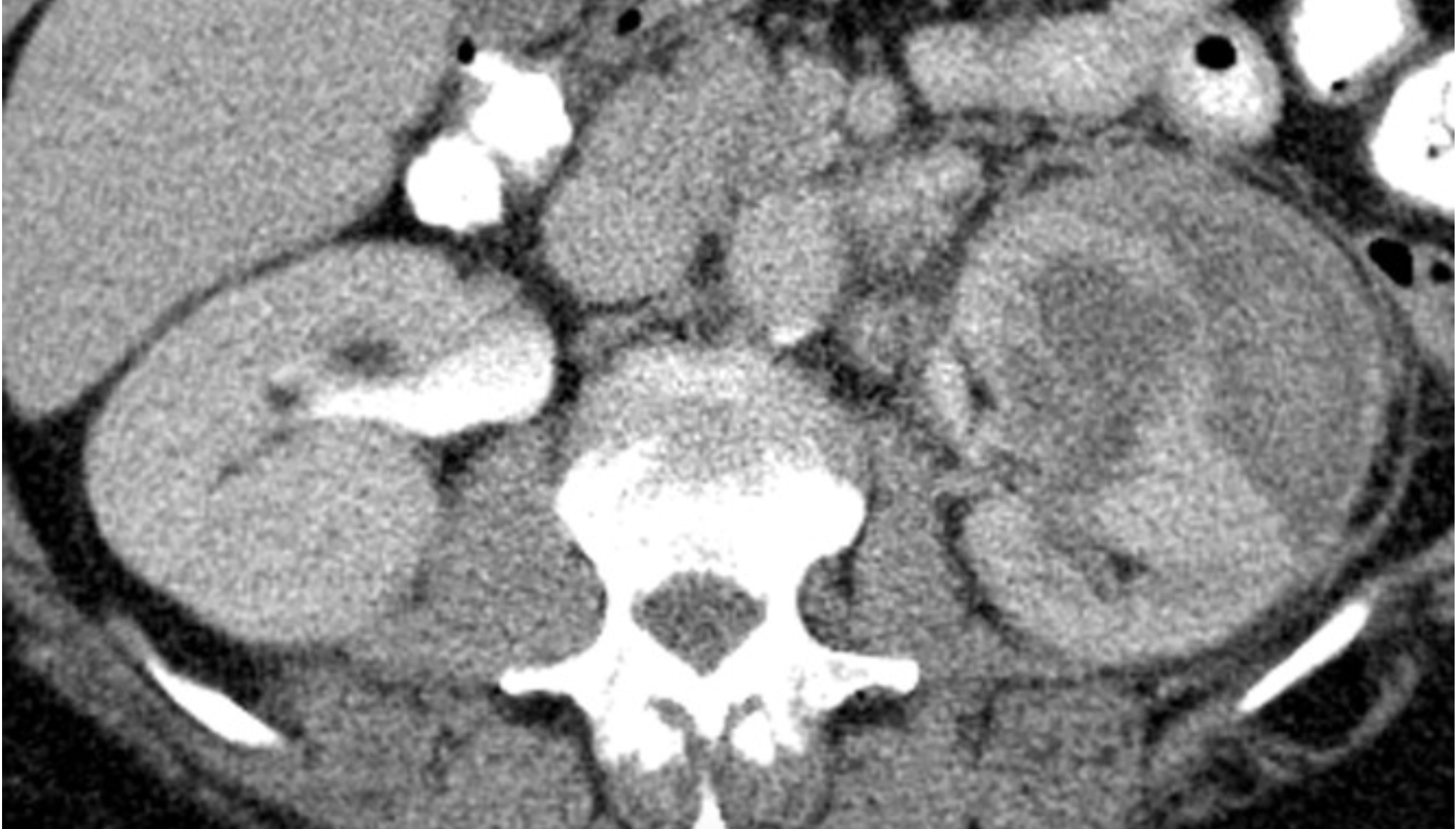 <p>What is being shown here? </p>