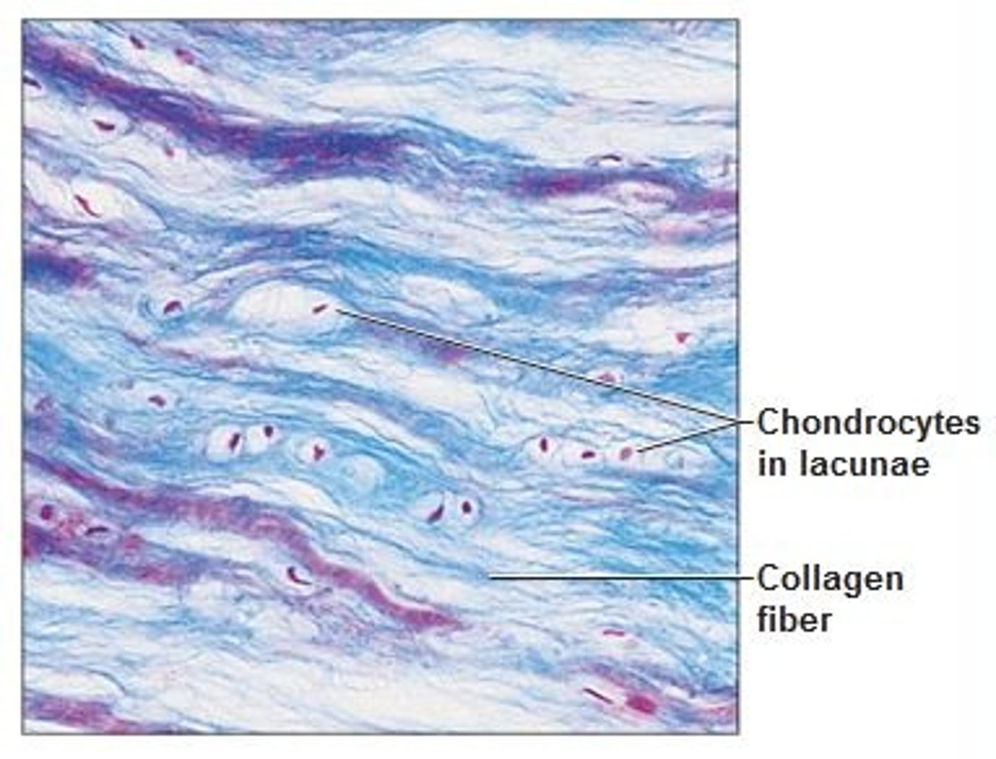 <p>- matrix similar to hyaline but less firm</p><p>- thick collagen fibres predominate</p>