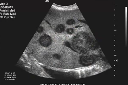 term image