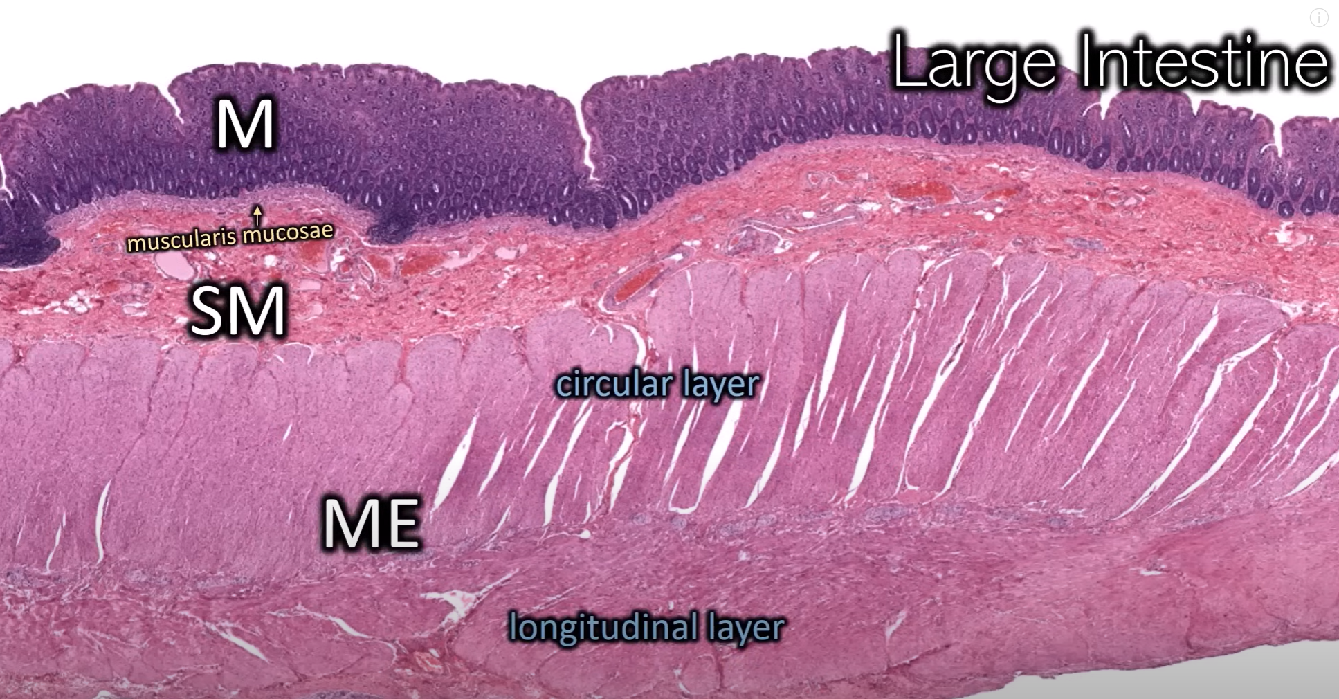 <p>Organ: Large intestine</p><p>Label: see image</p><p>Structure between: Myenteric (Auerbach’s) plexus</p>