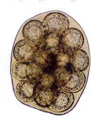 <p>Which parasite does this ova belong to?</p>