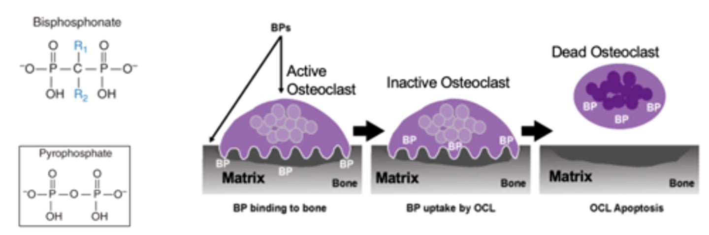 <p>-Analogs of pyrophosphate</p><p>-Bind to Ca and get incorporated into bone matrix and taken up by osteoclasts</p><p>-Within osteoclasts, BPs inhibit prenylation (attachment of certain lipids) to multiple proteins</p><p>-Decrease osteoclastic activity through apoptosis</p><p>-Increase bone density</p>