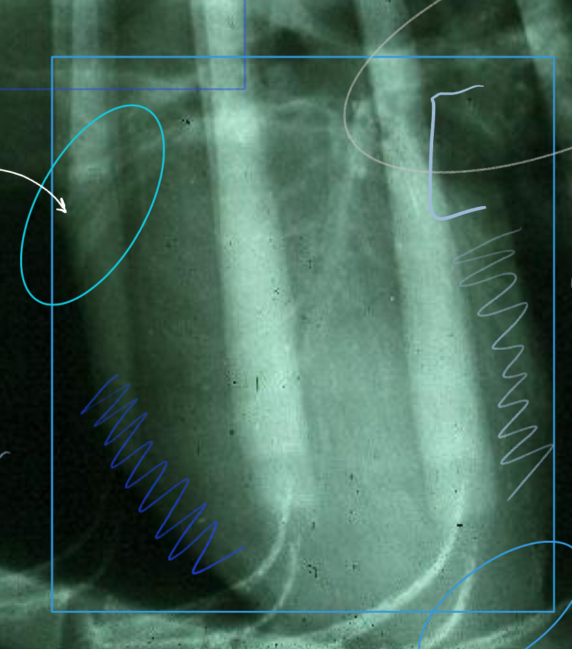 <p>turqouise oval (top L) </p>