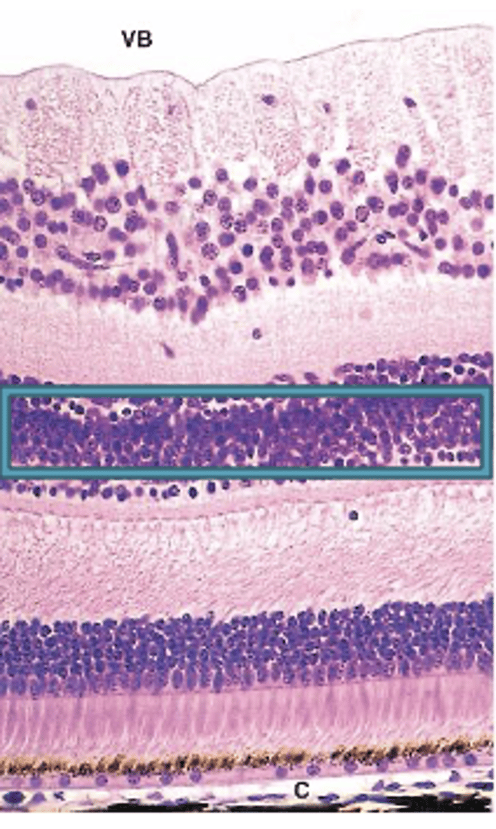 <p>Identify the Layers of the neural retina</p>