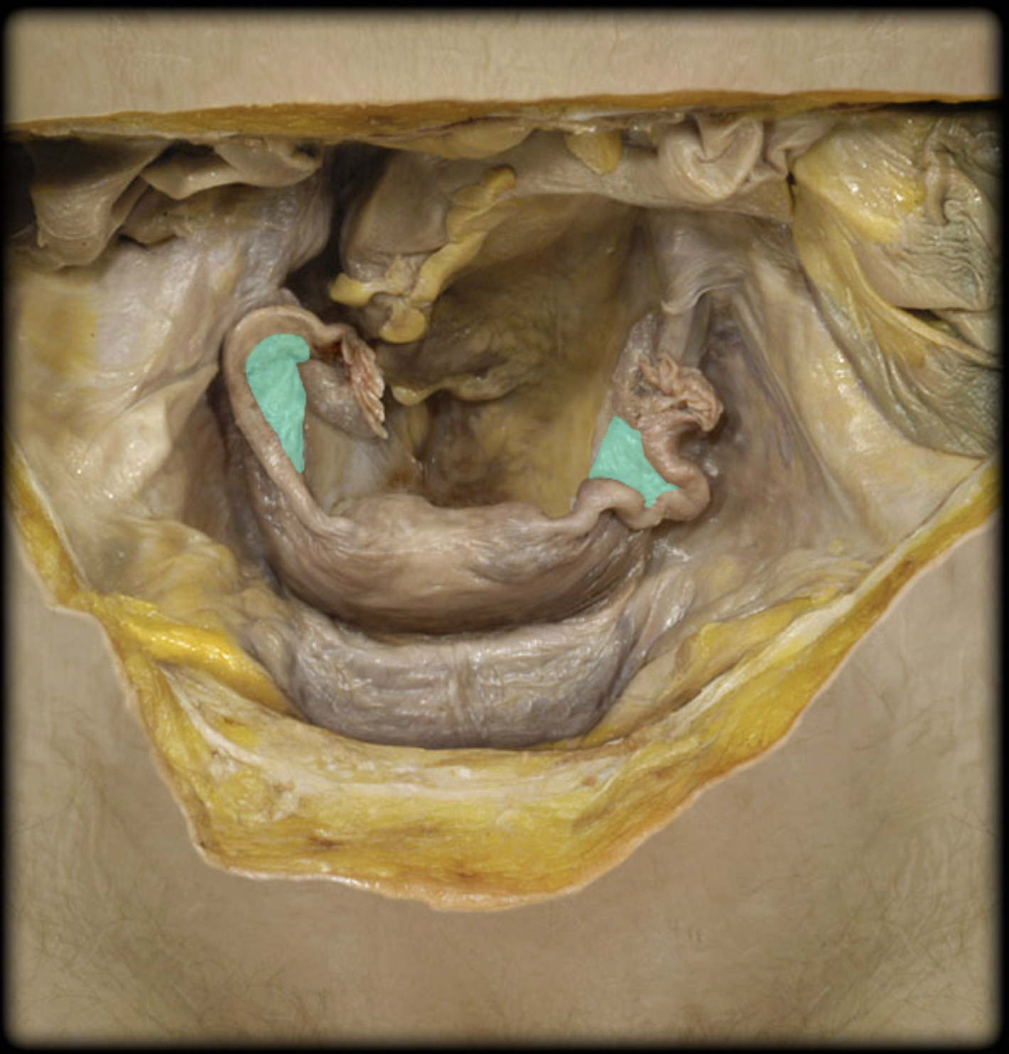 <p>What structure is shown?</p>