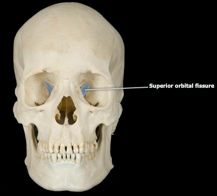 <p>superior orbital fissure</p>