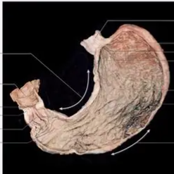 <p>A pouch in your upper belly that holds and churns food; digestion starts here.</p>