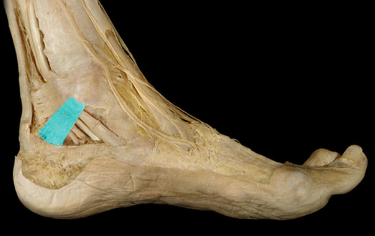 <p>behind lateral malleolus</p>