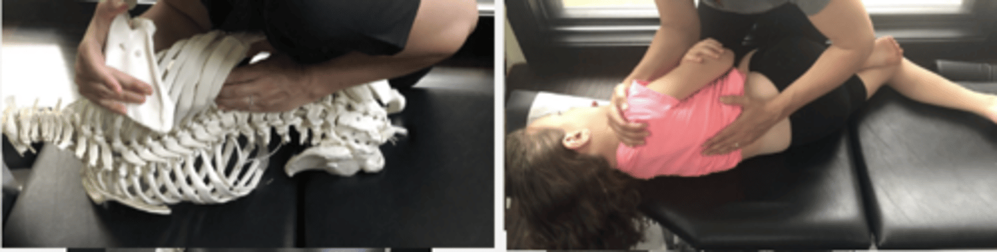 <p>PP: Basic side posture position with open wedge side up-verbalize how you found the segment</p><p>DP: Modified fencer stance on side of dysfunction</p><p>CH: Caudal (L) hand hypothenar on L3 MP with fingers runing parallel to spine</p><p>IH: Cephalic (R) hand slight downward traction holding the pt's up-side shoulder to assist in production of LF</p><p>LOD: P-A, L-M, S-I</p><p>(Lower the thoracolumbar section or place pt's down arm cephalad to induce LF)</p>