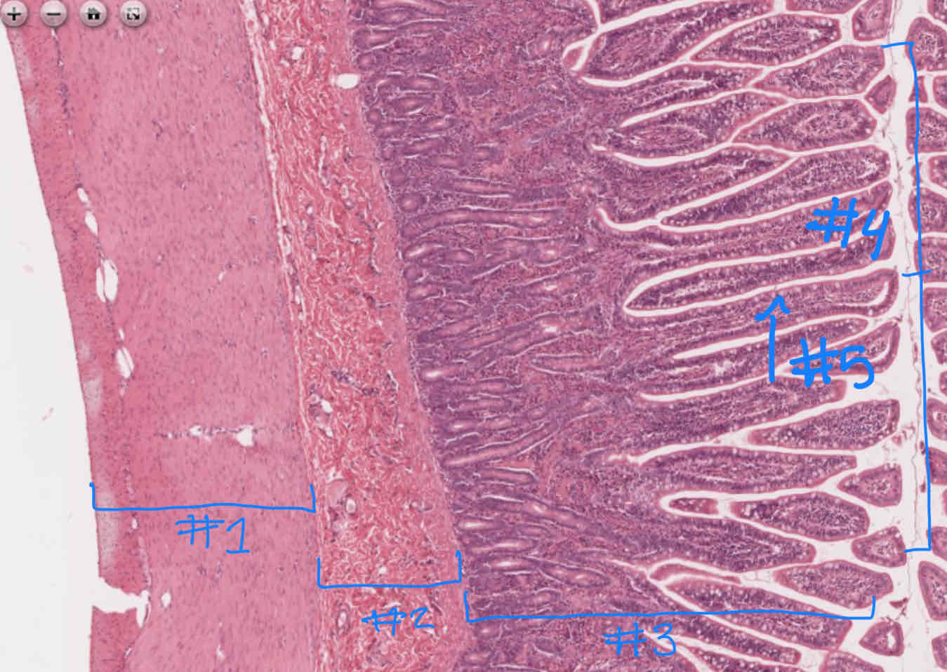 <p>What major layer is indicated by #1?</p>