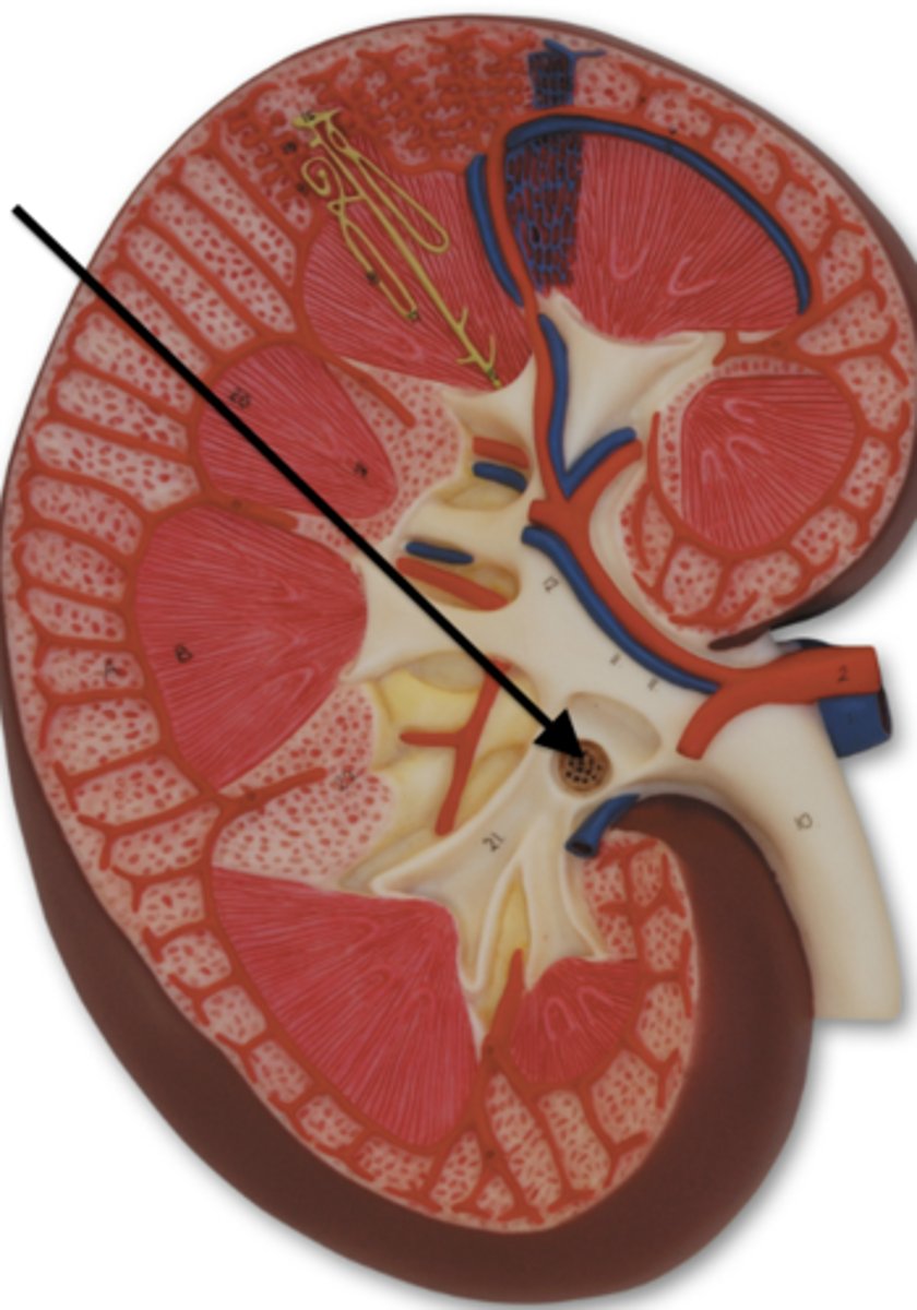 <p>what is the arrow pointing to?</p>