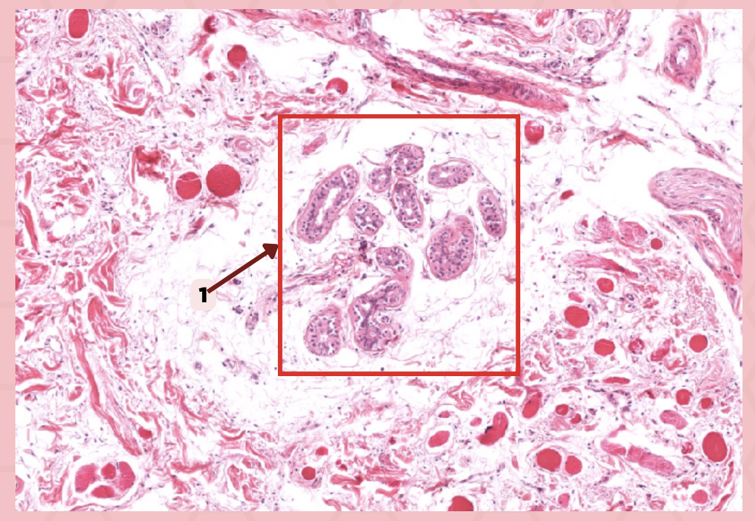 <p>What type of glands labelled as #1 as in the given image?</p><p>a. Apocrine glands</p><p>b. Eccrine glands</p><p>c. Merocrine glands</p><p>d. NOTA</p>