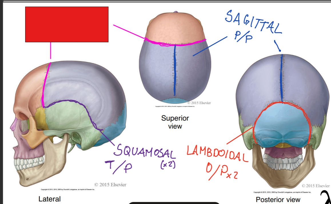<p>fill in the red box:</p>
