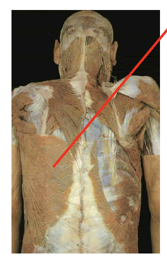 <p>What is this muscle. What is its origin. Where does it inserts. </p>