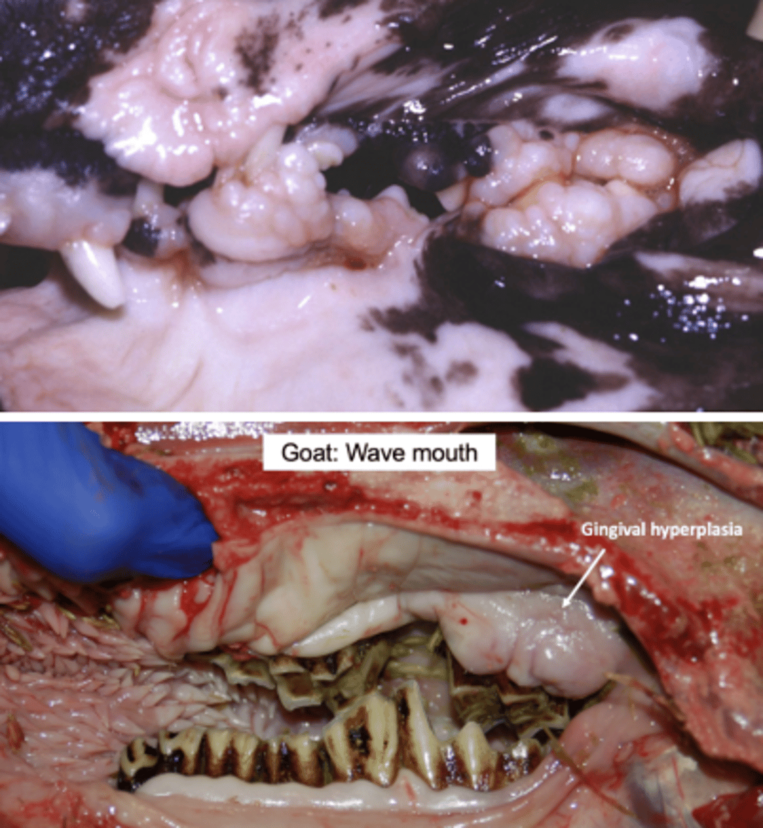 <p>- A localized lesion of overgrown gingival tissue which can obscure teeth</p>