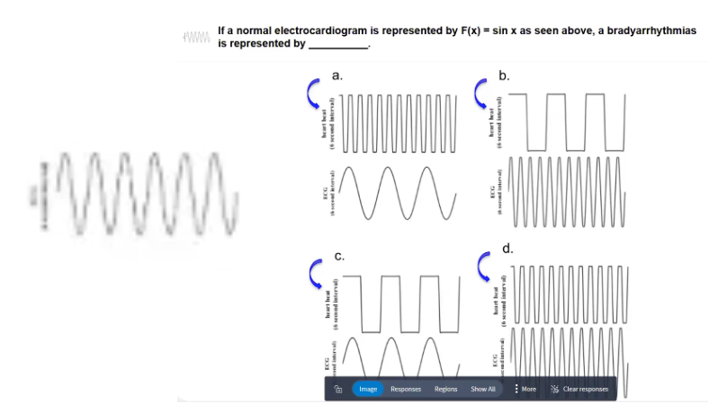 <p>POLLEV: If an normal electrocardiogram is represented by F(x) = sin x as seen above, a bradyarrhythmia is represented by _____.</p>