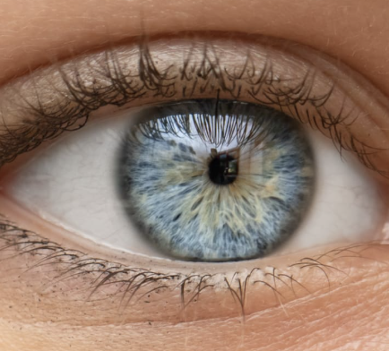 <p>4 Abnormal Findings for <strong><em>11. Inspect iris and pupil</em></strong></p><ul><li><p>Aka<strong> pinpoint pupils</strong></p></li><li><p>Characterized by constricted and fixed pupils</p></li><li><p>Possibly a result of narcotic drugs or brain damage</p></li></ul><p></p>