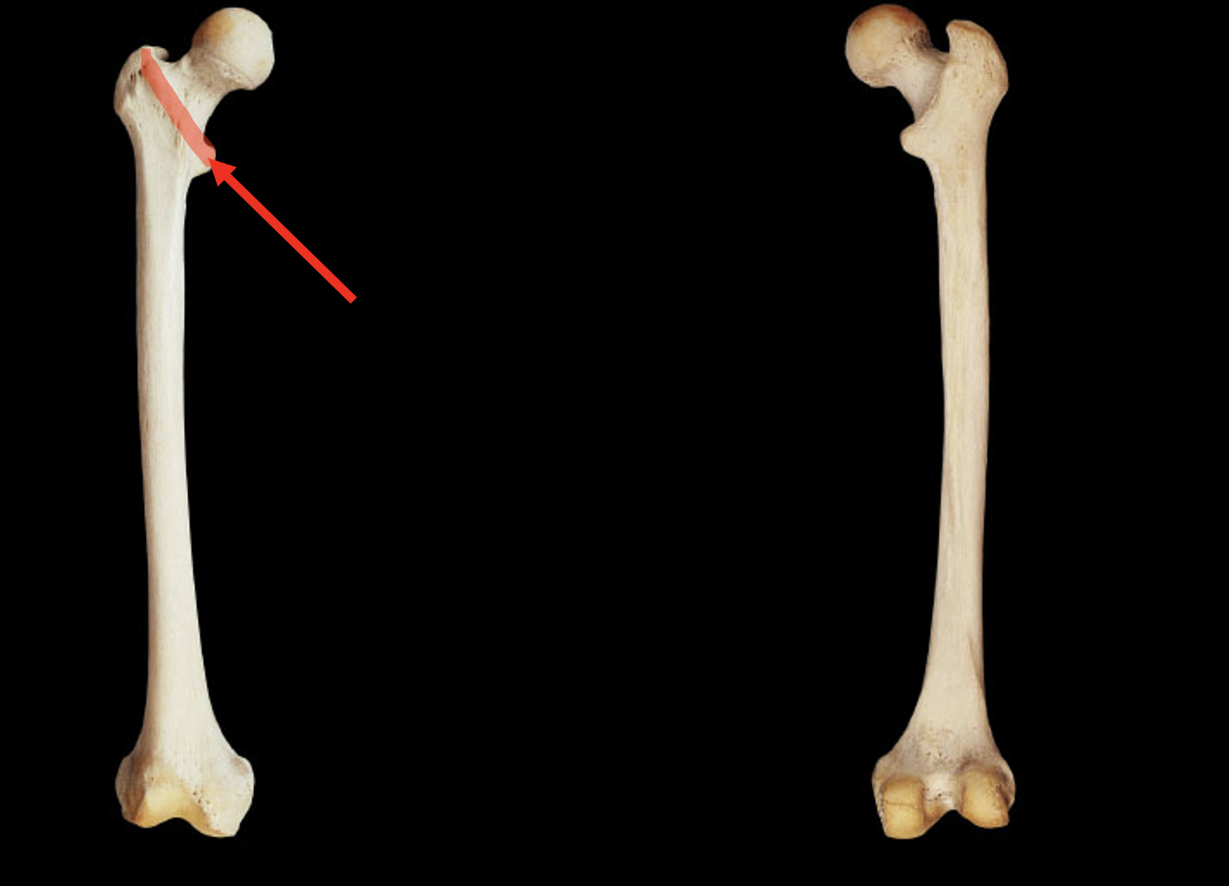 <p>Name this region of the femur</p>