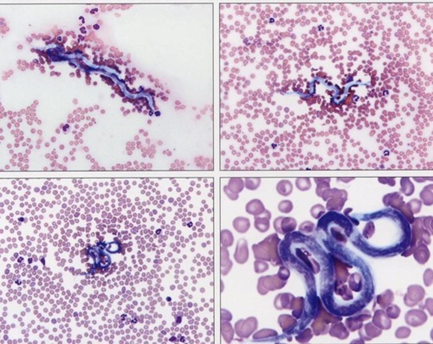 <p>Identify this blood extracellular organism. Be sure sure to call it my its scientific name.</p>