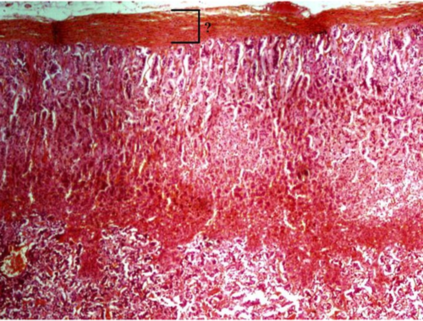 <p>Identify the indicated layer of the adrenal gland.</p>
