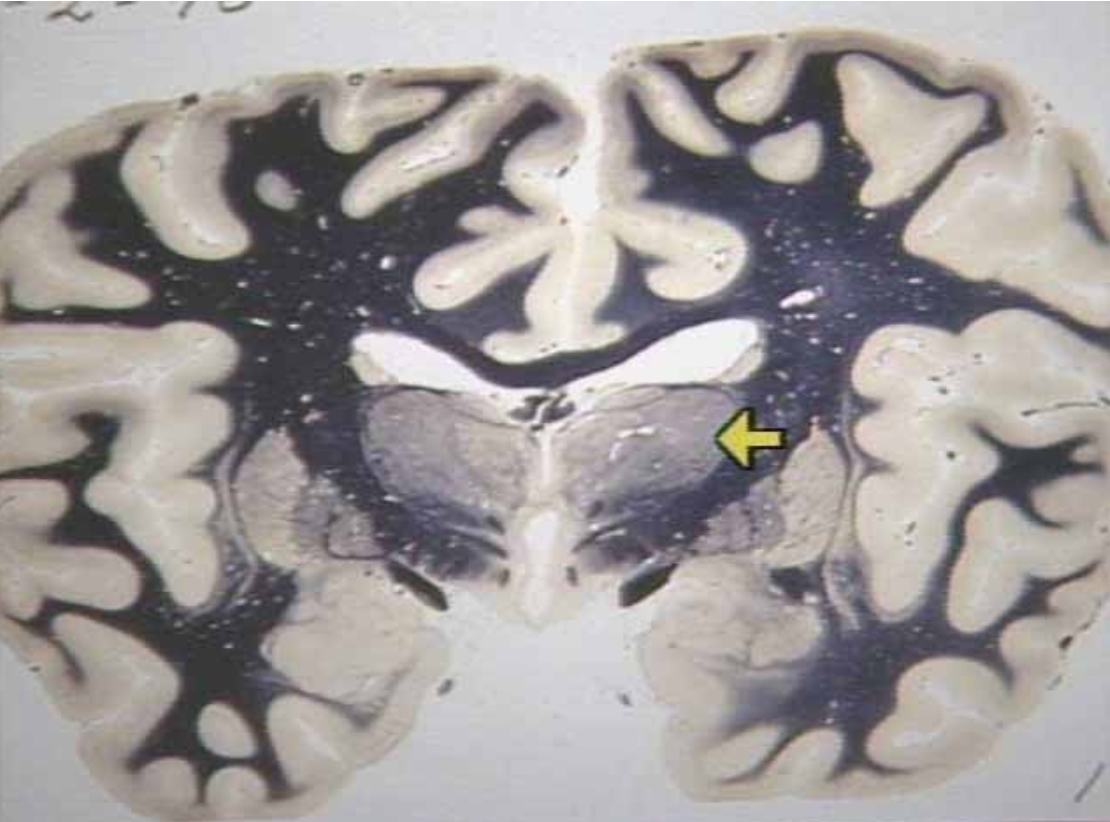 <p>What is the arrow pointing at?</p>